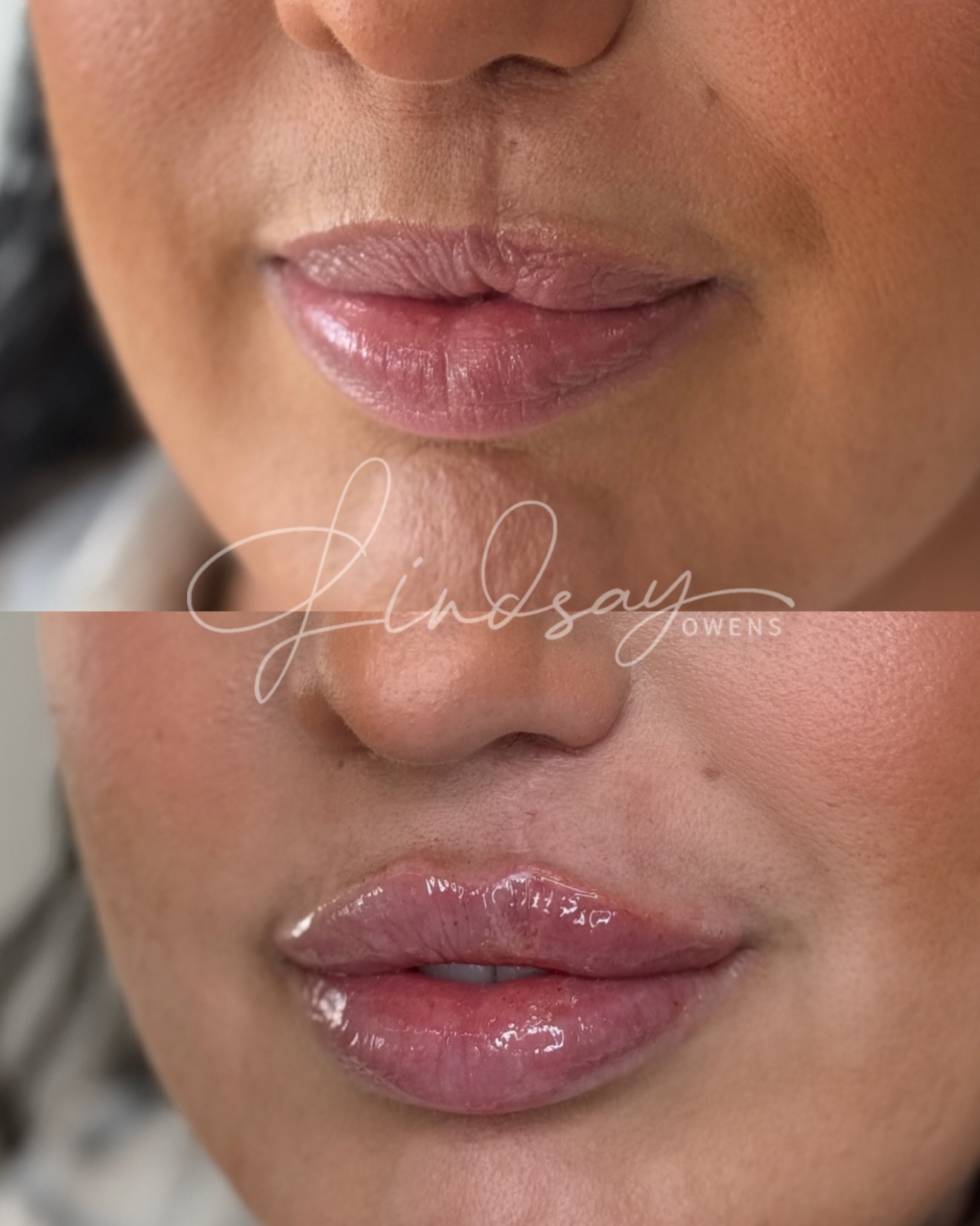 Refined contour and definition